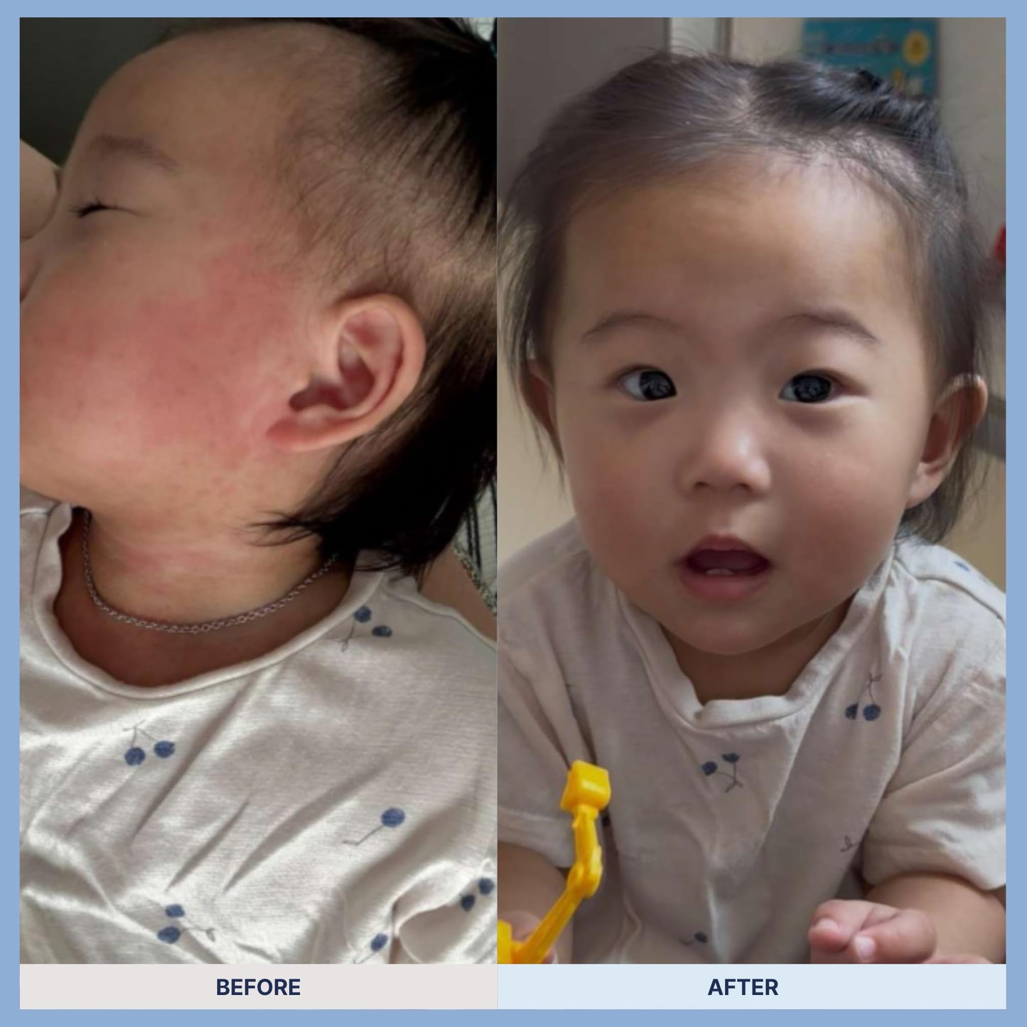 Baby Ato Lotion With Ceramide Moisture Care