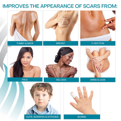 Medical Silicone Scar Sheets Breast Care Kit